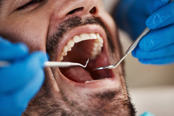 Best Urgent Dental Care for Toothaches in Holliday, TX